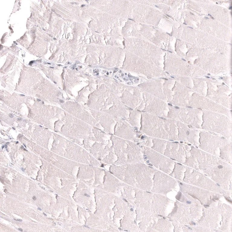 Immunohistochemistry (Formalin/PFA-fixed paraffin-embedded sections) - Anti-IL33 Antibody [CL13438] (AB327145)