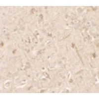 Immunohistochemistry (Formalin/PFA-fixed paraffin-embedded sections) - Anti-IL36 alpha/IL-1F6 antibody - C-terminal (AB180909)