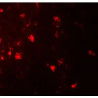 Immunohistochemistry (Formalin/PFA-fixed paraffin-embedded sections) - Anti-IL36 alpha/IL-1F6 antibody - C-terminal (AB180909)