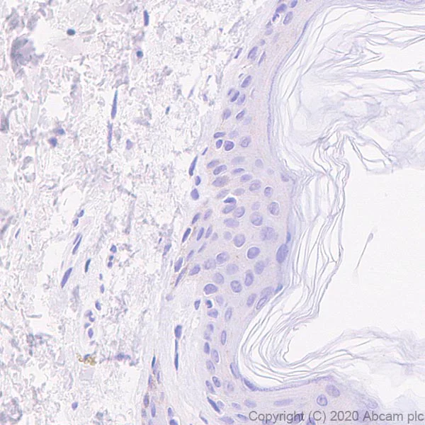 Immunohistochemistry (Formalin/PFA-fixed paraffin-embedded sections) - Anti-IL36 alpha/IL-1F6 antibody [EPR23089-87] (AB269271)