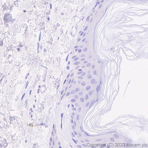 Immunohistochemistry (Formalin/PFA-fixed paraffin-embedded sections) - Anti-IL36 alpha/IL-1F6 antibody [EPR23089-87] - BSA and Azide free (AB270608), expandable thumbnail