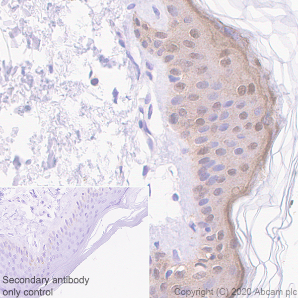 Immunohistochemistry (Formalin/PFA-fixed paraffin-embedded sections) - Anti-IL36 alpha/IL-1F6 antibody [EPR23152-241] (AB269274)