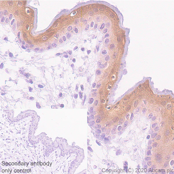 Immunohistochemistry (Formalin/PFA-fixed paraffin-embedded sections) - Anti-IL36 alpha/IL-1F6 antibody [EPR23152-241] (AB269274)