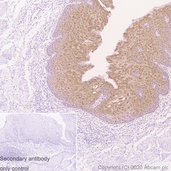 Immunohistochemistry (Formalin/PFA-fixed paraffin-embedded sections) - Anti-IL36 alpha/IL-1F6 antibody [EPR23152-241] (AB269274)