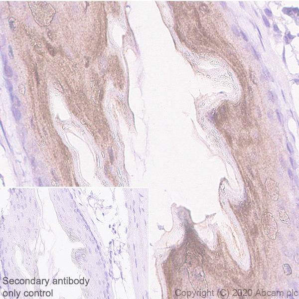 Immunohistochemistry (Formalin/PFA-fixed paraffin-embedded sections) - Anti-IL36 alpha/IL-1F6 antibody [EPR23152-241] (AB269274)