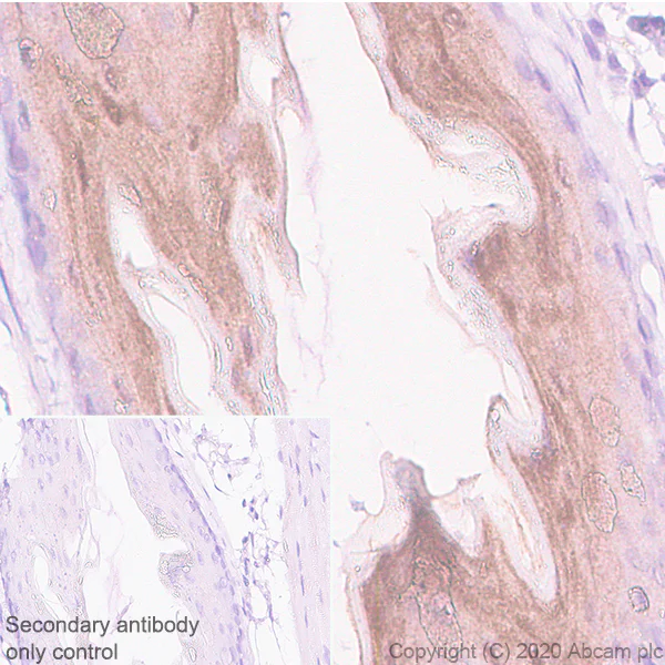 Immunohistochemistry (Formalin/PFA-fixed paraffin-embedded sections) - Anti-IL36 alpha/IL-1F6 antibody [EPR23152-241] (AB269274)