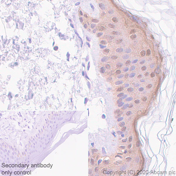 Immunohistochemistry (Formalin/PFA-fixed paraffin-embedded sections) - Anti-IL36 alpha/IL-1F6 antibody [EPR23152-241] - BSA and Azide free (AB272401)