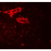 Immunocytochemistry/ Immunofluorescence - Anti-IL36 gamma/IL-1F9 antibody - C-terminal (AB180903)