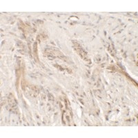 Immunohistochemistry (Formalin/PFA-fixed paraffin-embedded sections) - Anti-IL36 gamma/IL-1F9 antibody - C-terminal (AB180903)