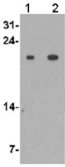 Western blot - Anti-IL36 gamma/IL-1F9 antibody - C-terminal (AB180903)