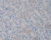 Immunohistochemistry (Formalin/PFA-fixed paraffin-embedded sections) - Anti-IL36 gamma/IL-1F9 antibody [D2] (AB239526)