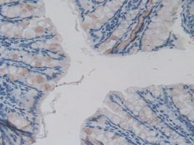 Immunohistochemistry (Formalin/PFA-fixed paraffin-embedded sections) - Anti-IL36 gamma/IL-1F9 antibody [D2] (AB239526)