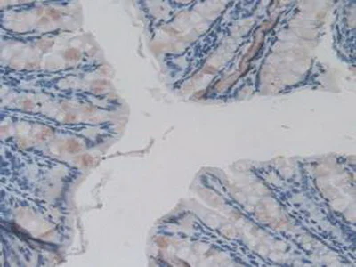 Immunohistochemistry (Formalin/PFA-fixed paraffin-embedded sections) - Anti-IL36 gamma/IL-1F9 antibody [D2] (AB239526)
