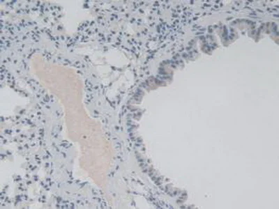 Immunohistochemistry (Formalin/PFA-fixed paraffin-embedded sections) - Anti-IL36 gamma/IL-1F9 antibody [D2] (AB239526)