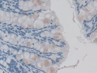 Immunohistochemistry (Formalin/PFA-fixed paraffin-embedded sections) - Anti-IL36 gamma/IL-1F9 antibody [D2] (AB239526)