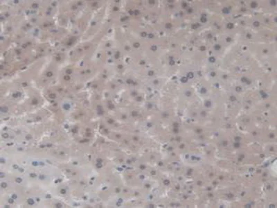 Immunohistochemistry (Formalin/PFA-fixed paraffin-embedded sections) - Anti-IL36 gamma/IL-1F9 antibody [D2] (AB239526)