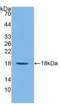 Western blot - Anti-IL36 gamma/IL-1F9 antibody [D2] (AB239526)