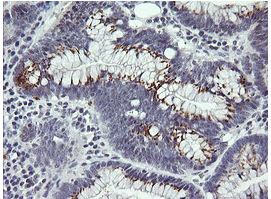 Immunohistochemistry (Formalin/PFA-fixed paraffin-embedded sections) - Anti-IL36 gamma/IL-1F9 antibody [OTI2F4] (AB156783)