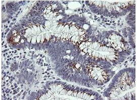 Immunohistochemistry (Formalin/PFA-fixed paraffin-embedded sections) - Anti-IL36 gamma/IL-1F9 antibody [OTI2F4] (AB156783)