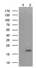 Western blot - Anti-IL36 gamma/IL-1F9 antibody [OTI2F4] (AB156783)