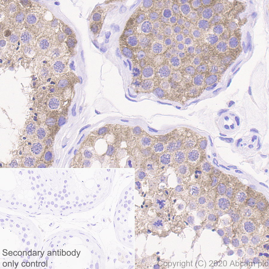 Immunohistochemistry (Formalin/PFA-fixed paraffin-embedded sections) - Anti-IL37 antibody [EPR24011-161] (AB278499)