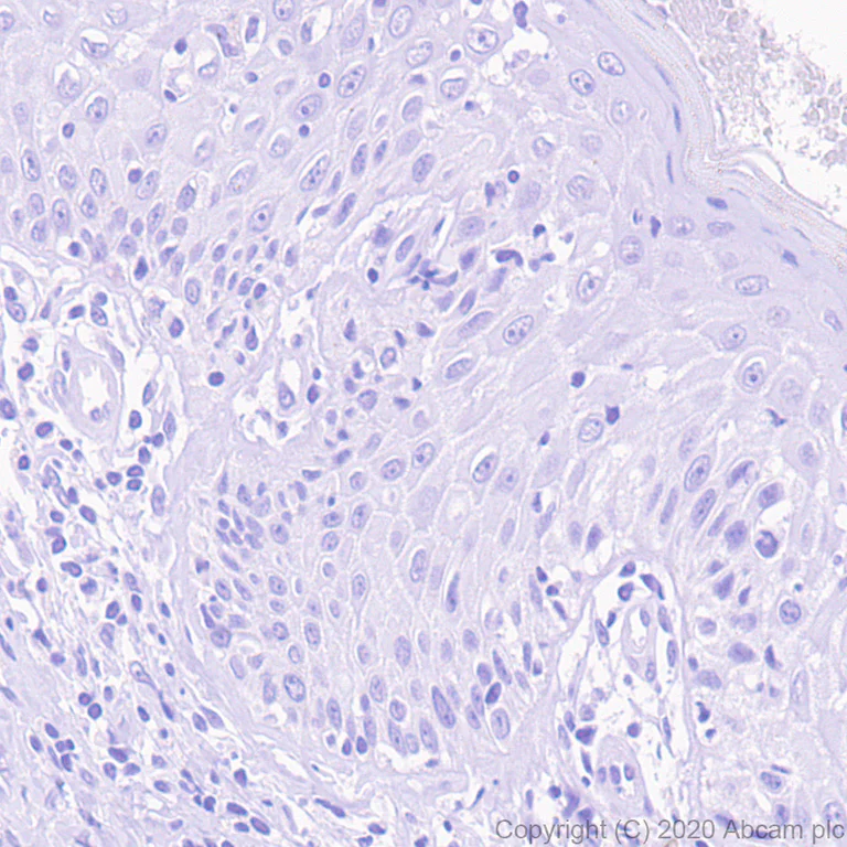 Immunohistochemistry (Formalin/PFA-fixed paraffin-embedded sections) - Anti-IL37 antibody [EPR24011-161] (AB278499)