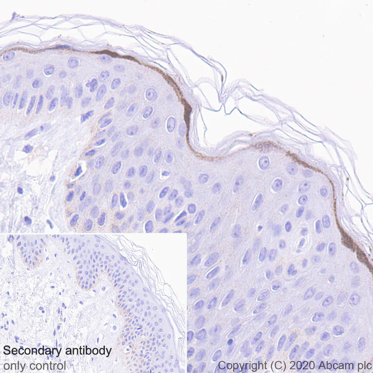 Immunohistochemistry (Formalin/PFA-fixed paraffin-embedded sections) - Anti-IL37 antibody [EPR24011-161] (AB278499)