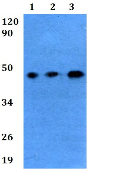 Western blot - Anti-IL3RA/CD123 antibody (AB200687)
