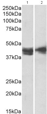 Western blot - Anti-IL3RA/CD123 antibody (AB205365)