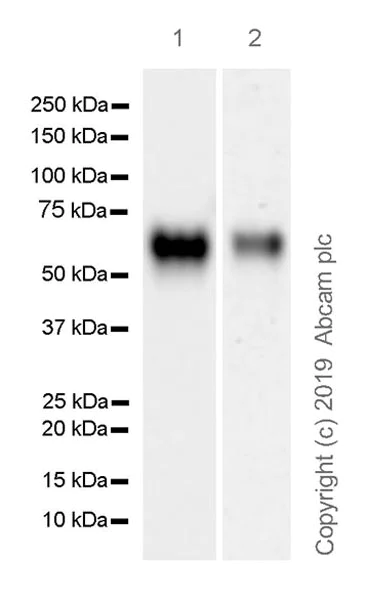 Western blot - Anti-IL3RA/CD123 antibody [EPR23188-72] (AB222103)