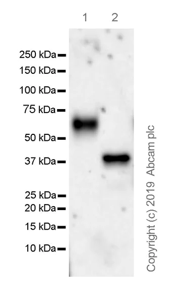 Western blot - Anti-IL3RA/CD123 antibody [EPR23188-72] (AB222103)