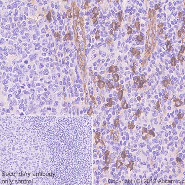 Immunohistochemistry (Formalin/PFA-fixed paraffin-embedded sections) - Anti-IL3RA/CD123 antibody [EPR23188-72] - BSA and Azide free (AB269871), expandable thumbnail
