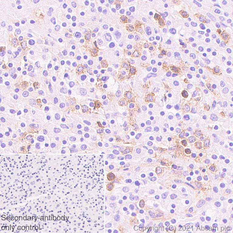 Immunohistochemistry (Formalin/PFA-fixed paraffin-embedded sections) - Anti-IL3RA/CD123 antibody [EPR24481-20] (AB280355)