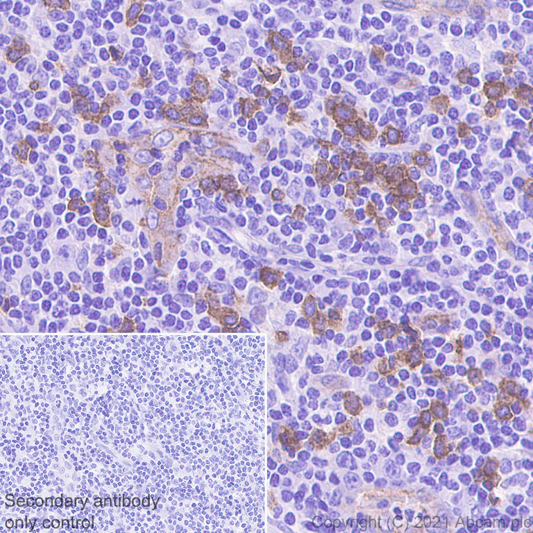 Immunohistochemistry (Formalin/PFA-fixed paraffin-embedded sections) - Anti-IL3RA/CD123 antibody [EPR24481-20] (AB280355)