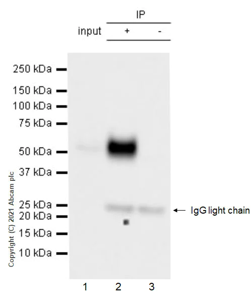 Immunoprecipitation - Anti-IL3RA/CD123 antibody [EPR24481-20] (AB280355)