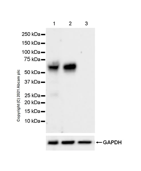 Western blot - Anti-IL3RA/CD123 antibody [EPR24481-20] (AB280355)