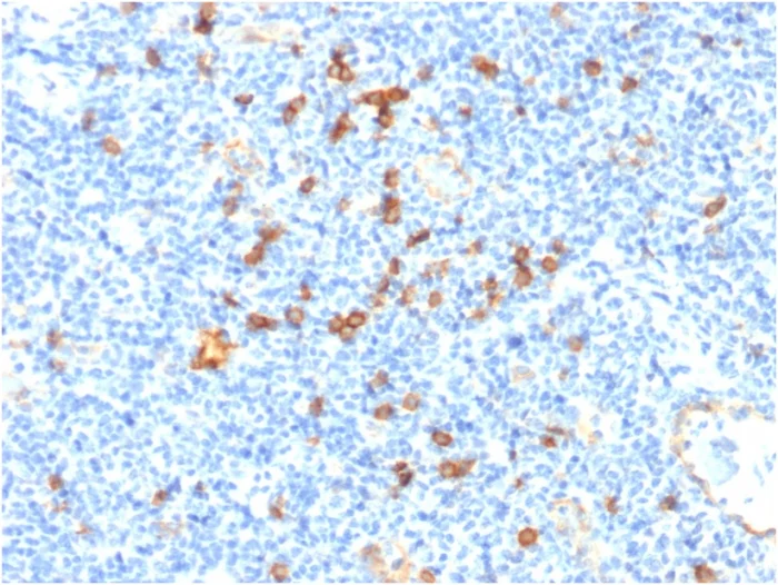 Immunohistochemistry (Formalin/PFA-fixed paraffin-embedded sections) - Anti-IL3RA/CD123 antibody [IL3RA/1531] - BSA and Azide free (AB268196)