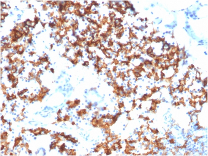 Immunohistochemistry (Formalin/PFA-fixed paraffin-embedded sections) - Anti-IL3RA/CD123 antibody [IL3RA/1531] - BSA and Azide free (AB268196)