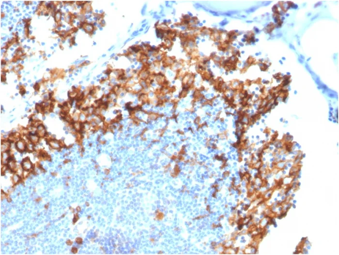 Immunohistochemistry (Formalin/PFA-fixed paraffin-embedded sections) - Anti-IL3RA/CD123 antibody [IL3RA/1531] - BSA and Azide free (AB268196)