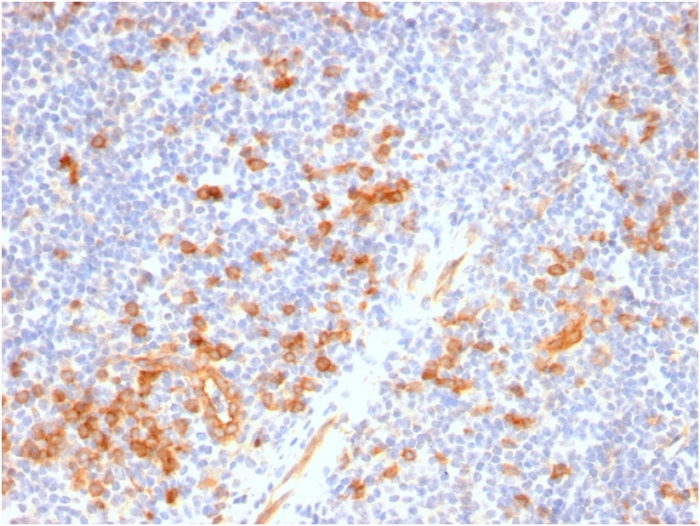 Immunohistochemistry (Formalin/PFA-fixed paraffin-embedded sections) - Anti-IL3RA/CD123 antibody [IL3RA/2947R] - BSA and Azide free (AB257324)