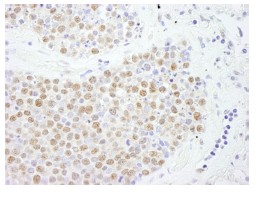 Immunohistochemistry (Formalin/PFA-fixed paraffin-embedded sections) - Anti-ILF1 antibody (AB84761)
