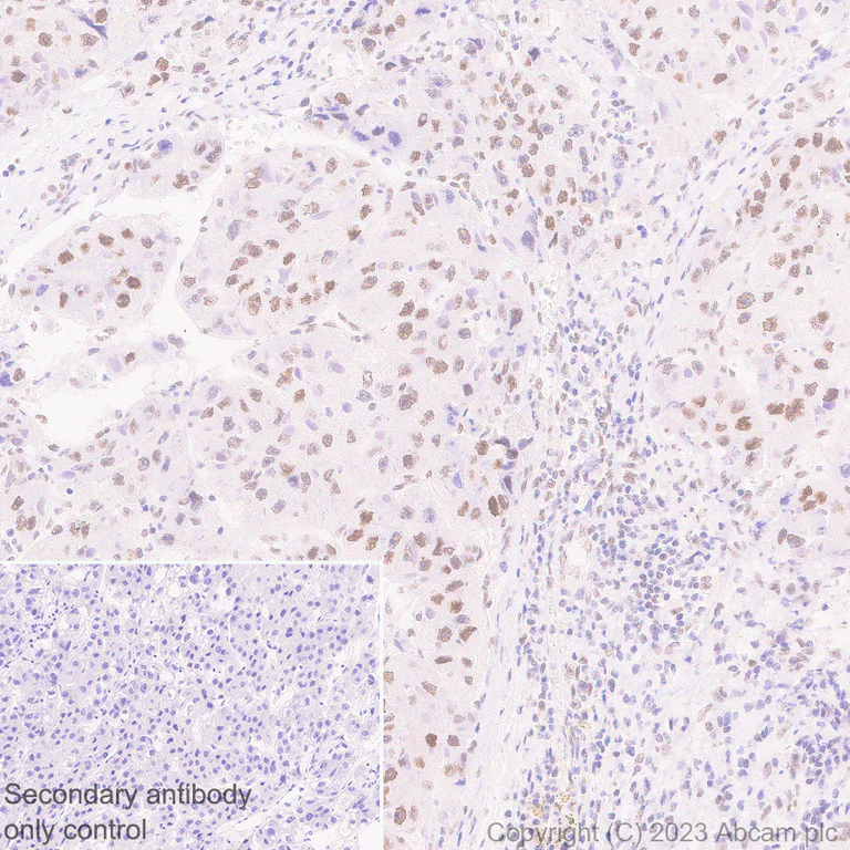 Immunohistochemistry (Formalin/PFA-fixed paraffin-embedded sections) - Anti-ILF1 antibody [EPR27321-60] (AB309489)