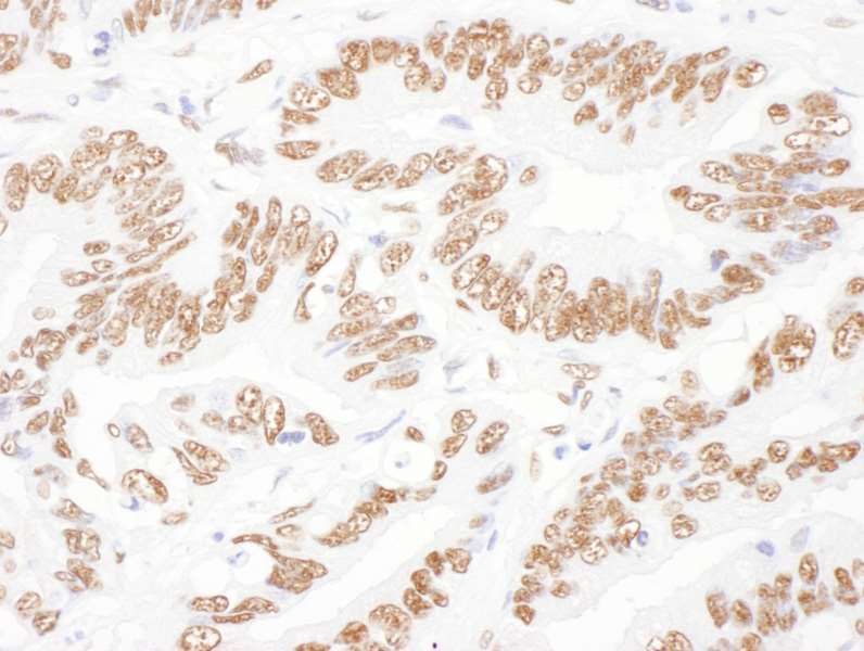 Immunohistochemistry (Formalin/PFA-fixed paraffin-embedded sections) - Anti-ILF2/NF45 antibody (AB113205)