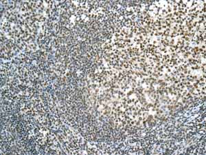 Immunohistochemistry (Formalin/PFA-fixed paraffin-embedded sections) - Anti-ILF2/NF45 antibody [EPR10694(B)] (AB154169)