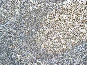 Immunohistochemistry (Formalin/PFA-fixed paraffin-embedded sections) - Anti-ILF2/NF45 antibody [EPR10694(B)] (AB154169)