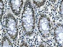 Anti-ILF2/NF45 antibody [EPR10694(B)]