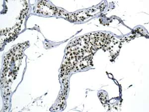 Immunohistochemistry (Formalin/PFA-fixed paraffin-embedded sections) - Anti-ILF2/NF45 antibody [EPR10694(B)] - BSA and Azide free (AB249069)