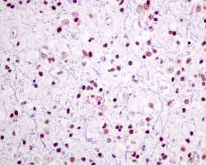 Immunohistochemistry (Formalin/PFA-fixed paraffin-embedded sections) - Anti-ILF2/NF45 antibody [EPR10695(B)] (AB154791)