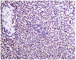 Anti-ILF2/NF45 antibody [EPR10695(B)]