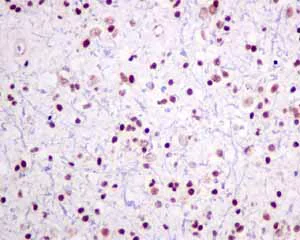 Immunohistochemistry (Formalin/PFA-fixed paraffin-embedded sections) - Anti-ILF2/NF45 antibody [EPR10695(B)] - BSA and Azide free (AB249101)